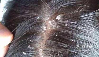 ���ʶ��ͷ���Ƿ�����������